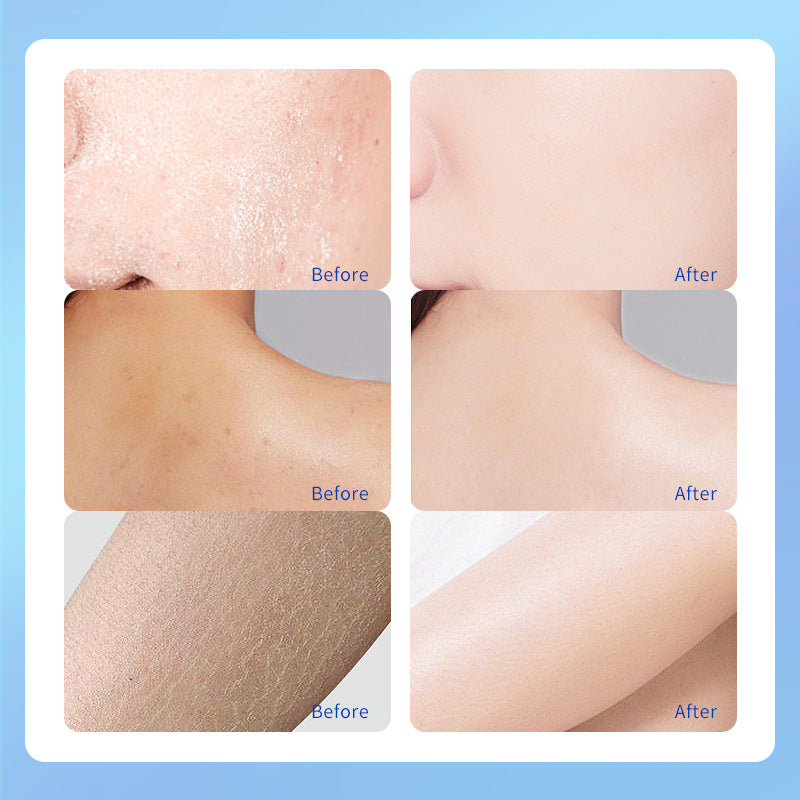 Urea Intensive Repair & Moisturizing Cream
