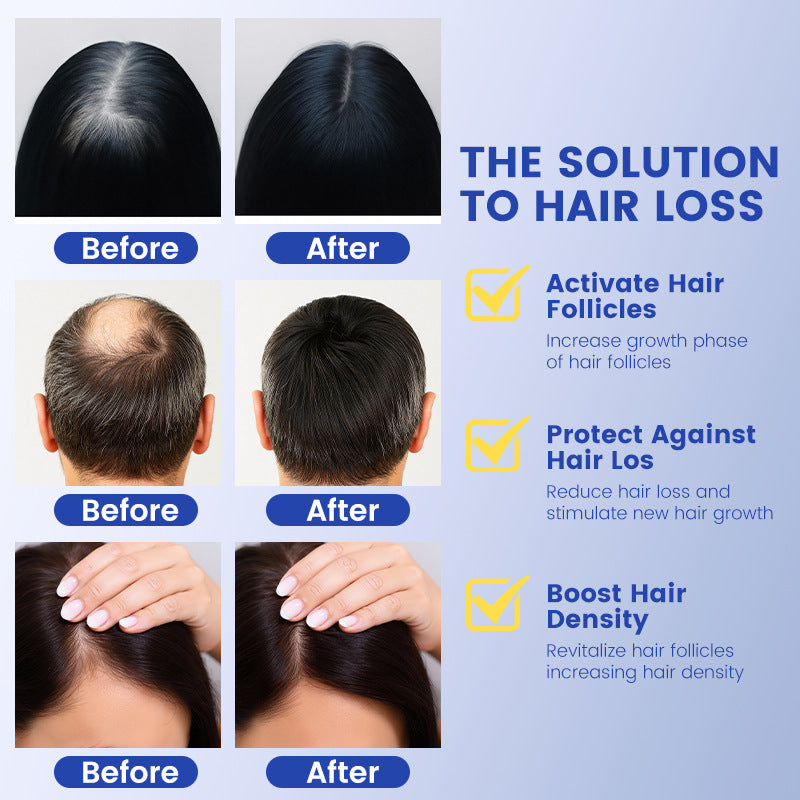 Copper Peptide Hair Growth Serum