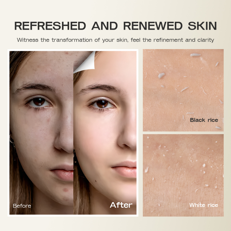 Black Rice Exfoliating Renewal Ampoule